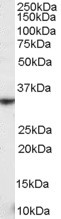 Anti-NKG2D / KLRK1, Internal