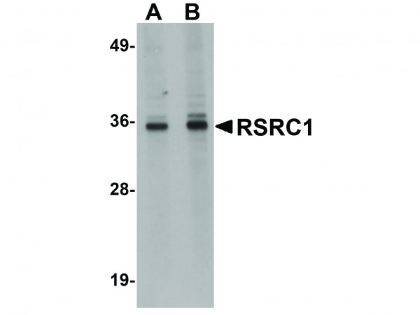 Anti-RSRC1