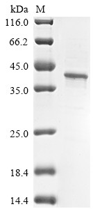 Glutathione S-transferase (GST), Plasmodium falciparum, recombinant