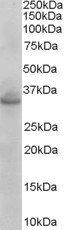 Anti-STX1A / STX1B, N-terminal