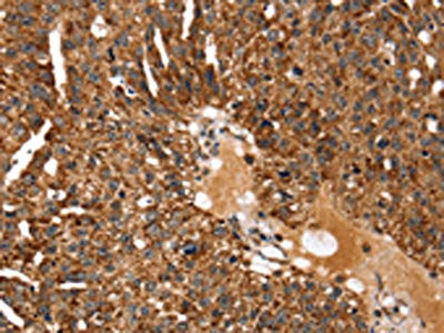 Anti-KCNH6