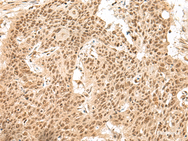 Anti-GMEB2