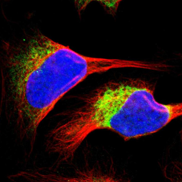 Anti-RRBP1