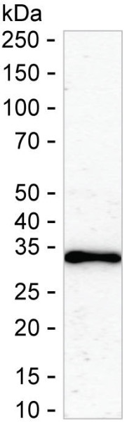 Anti-EXOSC8