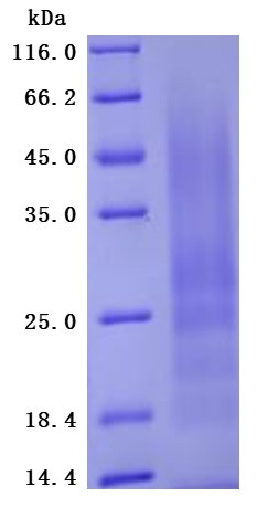 Myosin regulatory light polypeptide 9 (MYL9) (Active), human, recombinant