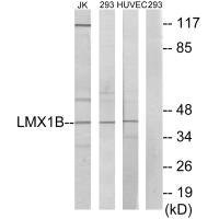 Anti-LMX1B