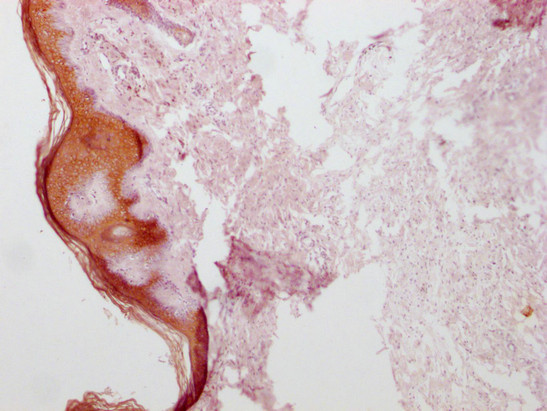Anti-KRT1 Monoclonal