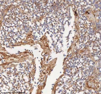 Anti-MIPEP / Mitochondrial intermediate peptidase
