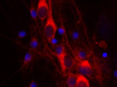 Anti-14-3-3 eta, clone 3G12