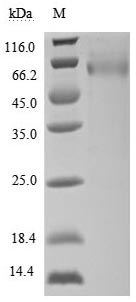 UL16-binding protein 1 (ULBP1) (Active), human, recombinant