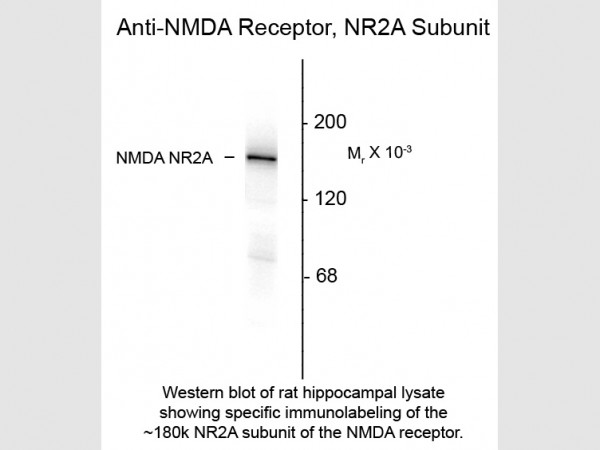 Anti-NMDA R2A