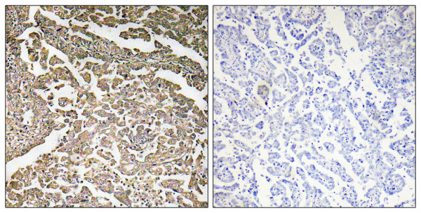Anti-PKA gamma (catalytic subunit)