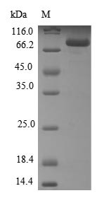 Steroid 21-hydroxylase (CYP21A2), human, recombinant