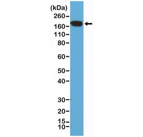 Anti-EGF Receptor / EGFR / C-Terminal (recombinant antibody), clone RM294