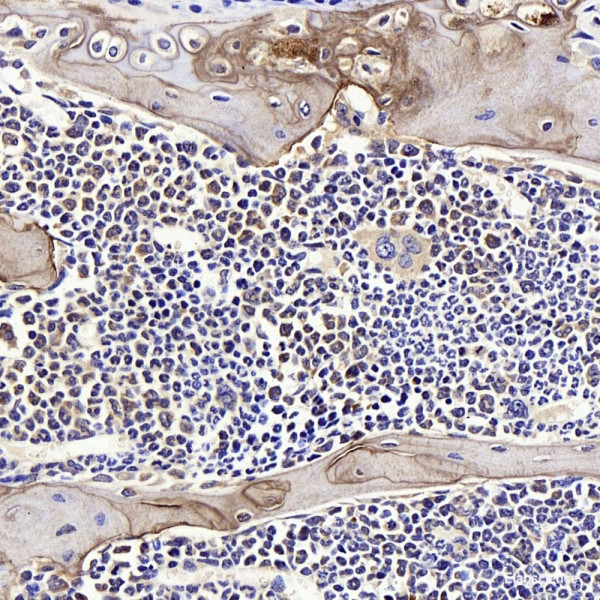 Anti-SPP1