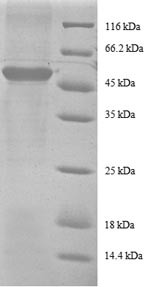 40S ribosomal protein S9 (RPS9), partial, human, recombinant