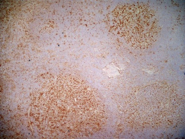 Anti-CD40, clone LOB7/6