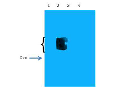 Anti-Beta Amyloid pyro E11
