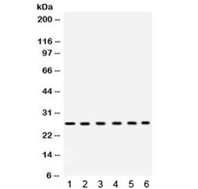Anti-EIF6 / Eukaryotic Translation Initiation Factor 6