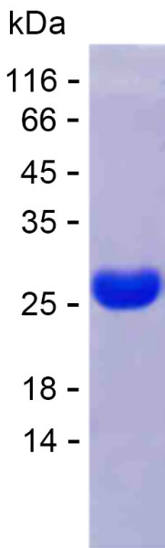 Recombinant Human HERPUD2 Protein