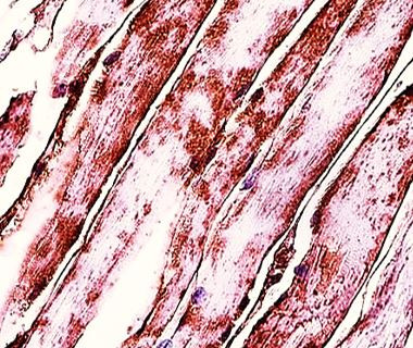 Anti-Myosin light chain 3