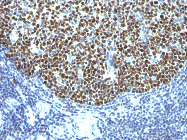 Anti-Bcl-6 (Follicular Lymphoma Marker), clone SPM602