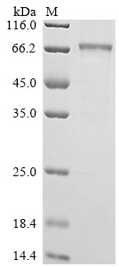 Interleukin-12 receptor subunit beta-1 (IL12RB1), partial, human, recombinant