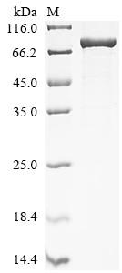 Desmin (DES), human, recombinant