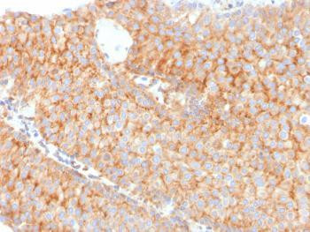 Anti-PAI-RBP1 / SERBP1 / SERPINE1 Monoclonal Antibody (Clone: SERBP1/3491)