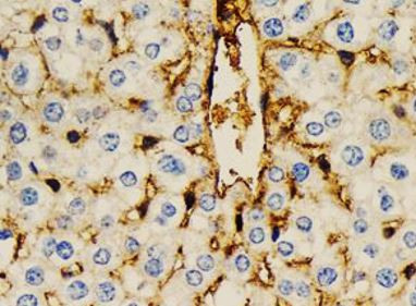 Anti-SERPING1 / C1 Inhibitor