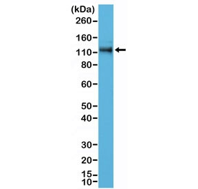 Anti-p120-Catenin / CTNND1 / Catenin delta 1 (recombinant antibody), clone RM353