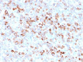 Anti-Tyrosinase (Melanoma Marker) Recombinant Mouse Monoclonal Antibody (clone:rOCA1/812)