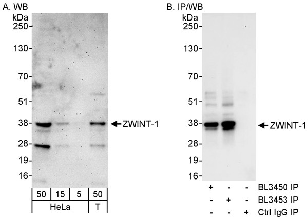 Anti-ZWINT-1