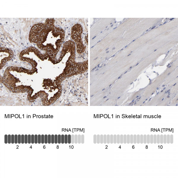 Anti-MIPOL1