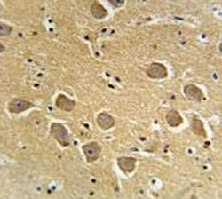 Anti-AQP11