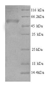 AP-2 complex subunit mu (AP2M1), human, recombinant