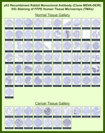 Anti-p63 / Tumor protein 63, clone MSVA-063R