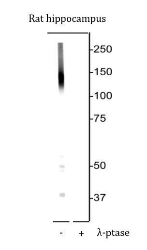 Anti-phospho-KCC2 / Potassium Chloride Cotransporter (Thr1007)