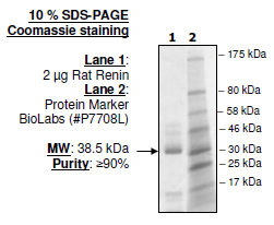 Renin, rat recombinant protein, His-tag