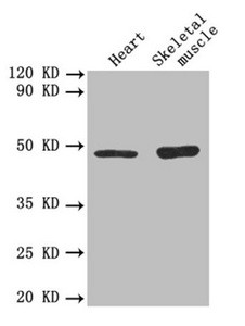 Anti-TGFB2