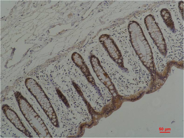 Anti-HSP90AA1