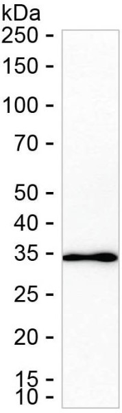 Anti-PRKAB2