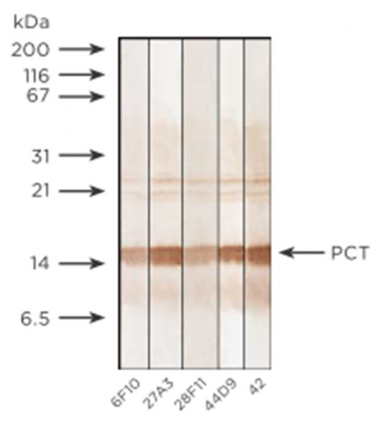 Anti-Procalcitonin, clone 27A3