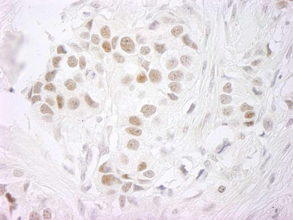 Anti-PPP4R3 Beta (IHC)