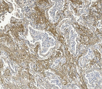 Anti-ITGB5 / Integrin beta 5