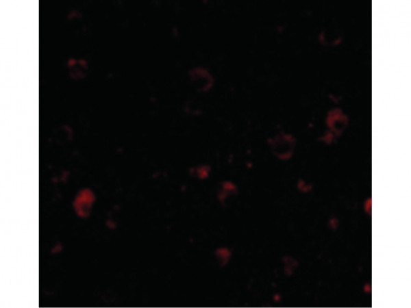 Anti-BRSK1