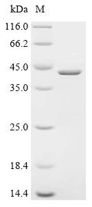 G antigen 7 (GAGE7), recombinant human