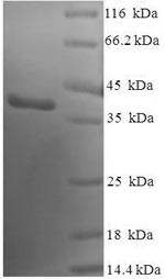 Sentrin-specific protease 8 (SENP8), human, recombinant