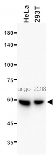 Anti-Vimentin, clone SQab1721
