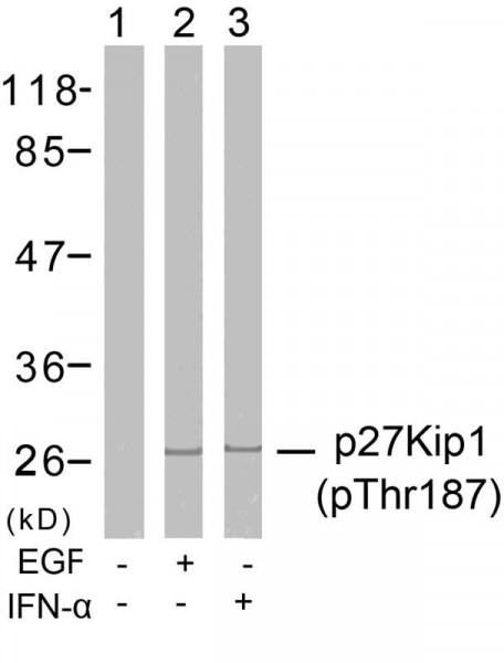 Anti-phospho-p27 Kip1 (Thr187)